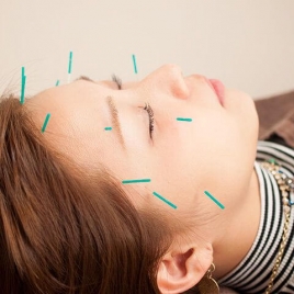 赤坂NEP'S 鍼灸整骨院 整体マッサージ院 赤坂見附院 美容鍼のメニュー画像