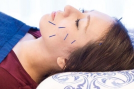 桜整骨・鍼灸院　宝ヶ池本店 美容鍼　百華のメニュー画像