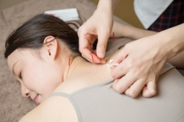 ともえ鍼灸整骨院 トリガーポイント鍼治療のメニュー画像