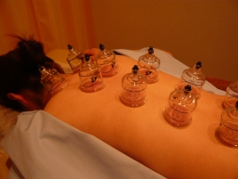 マッサージ＆はりきゅう院　温流 温流　カッピング療法（吸い玉）のメニュー画像