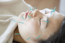 マッサージ・はり・きゅう治療SHOKO 美容鍼灸のメニュー画像