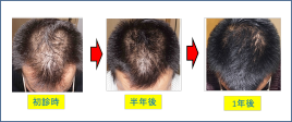 Teaching Beauty鍼灸マッサージ整骨院・整体院 薄毛、若ハゲ治療(男女可)のメニュー画像