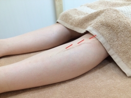 北の谷の鍼灸院 (Seaside Acupuncture Center) 鍼灸治療☆全身調整☆のメニュー画像