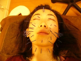 治療の森　鍼灸整骨院 美顔鍼ショートコースのメニュー画像