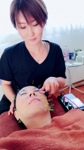 shishira (シシラ）はり灸治療院 美容鍼灸トライアルのメニュー画像