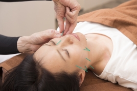 しみず接骨院・鍼灸院 美顔鍼のメニュー画像