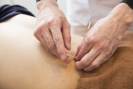 しみず接骨院・鍼灸院 鍼灸治療のメニュー画像