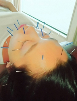 ハリラックス阿倍野　整体鍼灸院 結果にこだわる「ハリラックス式美顔鍼灸」のメニュー画像