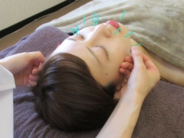鍼灸院ハリーナ 美容鍼ベーシック（お顔の鍼+全身鍼灸）のメニュー画像