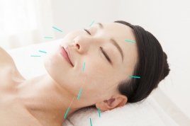 あさの鍼灸院 *。‘*。美容鍼スタンダード*。‘*。のメニュー画像