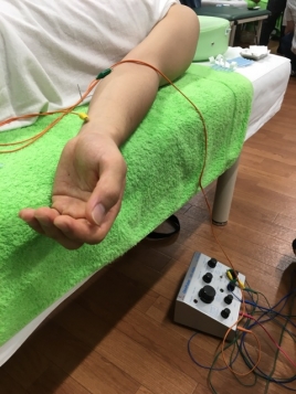 神田ふれあい鍼灸整骨院 鍼治療のメニュー画像