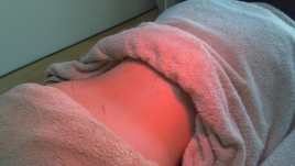 なぎの木鍼灸治療院 鍼灸による不妊体質改善　  のメニュー画像