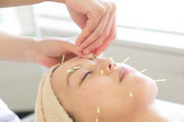 神戸東洋医療学院付属治療院 美容鍼のメニュー画像