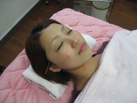 清香鍼灸治療院 美容顔鍼のメニュー画像