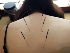 はり・きゅう・リラクゼーション　３６０ 【メンテナンスコース】のメニュー画像