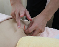 神田ふれあい鍼灸整骨院 鍼治療のメニュー画像