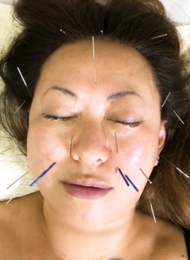 はりきゅう玉響　Tamayura Acupuncture&Moxibustion 美容鍼灸のメニュー画像