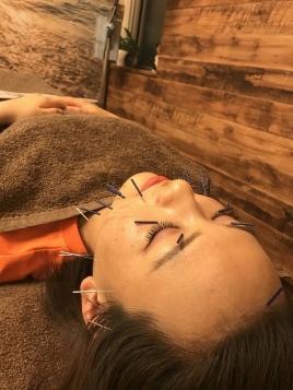 斉藤鍼温灸マッサージ院 美容鍼のメニュー画像