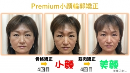 京都中央整骨院/はり灸院 premium小顔輪郭矯正のメニュー画像