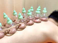 川口統合整骨院・鍼灸院 カッピングのメニュー画像