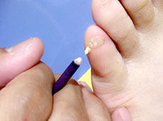 川口統合整骨院・鍼灸院 逆子治療のメニュー画像