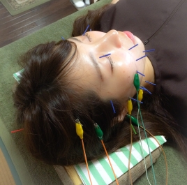 美容鍼灸サロン Hallume 初回特別価格 微弱電流美容鍼 60分のメニュー画像