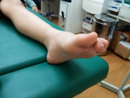 あいメディカル治療院・整骨院 足専門外来・足底板療法のメニュー画像