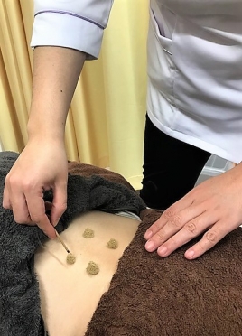 わちゅう堂鍼灸治療院 全身調整で根本から症状改善プランのメニュー画像