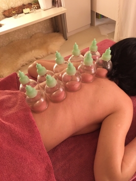 津田沼るぴにあ鍼灸処 カッピングのメニュー画像