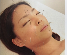 健美鍼灸整骨院 美容鍼のメニュー画像
