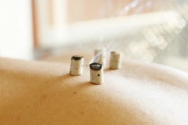 くろき鍼灸整骨院 お灸施術＋整体のメニュー画像