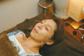 総合治療院松本 美容鍼のメニュー画像