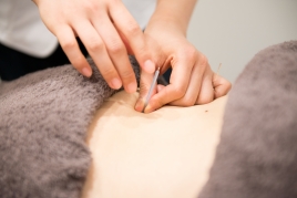 iCure鍼灸接骨院 人形町 鍼治療のメニュー画像
