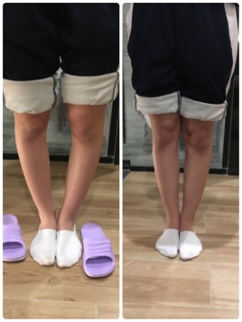 治療室　ノブ Ｏ脚、Ｘ脚の治療のメニュー画像