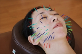 美容バランス 100本美容鍼コースのメニュー画像