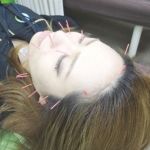 Axis鍼灸整骨院　恵美須店 美容鍼のメニュー画像