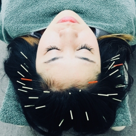 渋谷スポンジ 鍼のヘッドスパのメニュー画像
