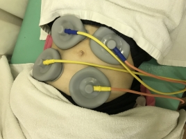 東砂ひかりクリニカル鍼灸整体院 産後骨盤ダイエット器械EMS のメニュー画像