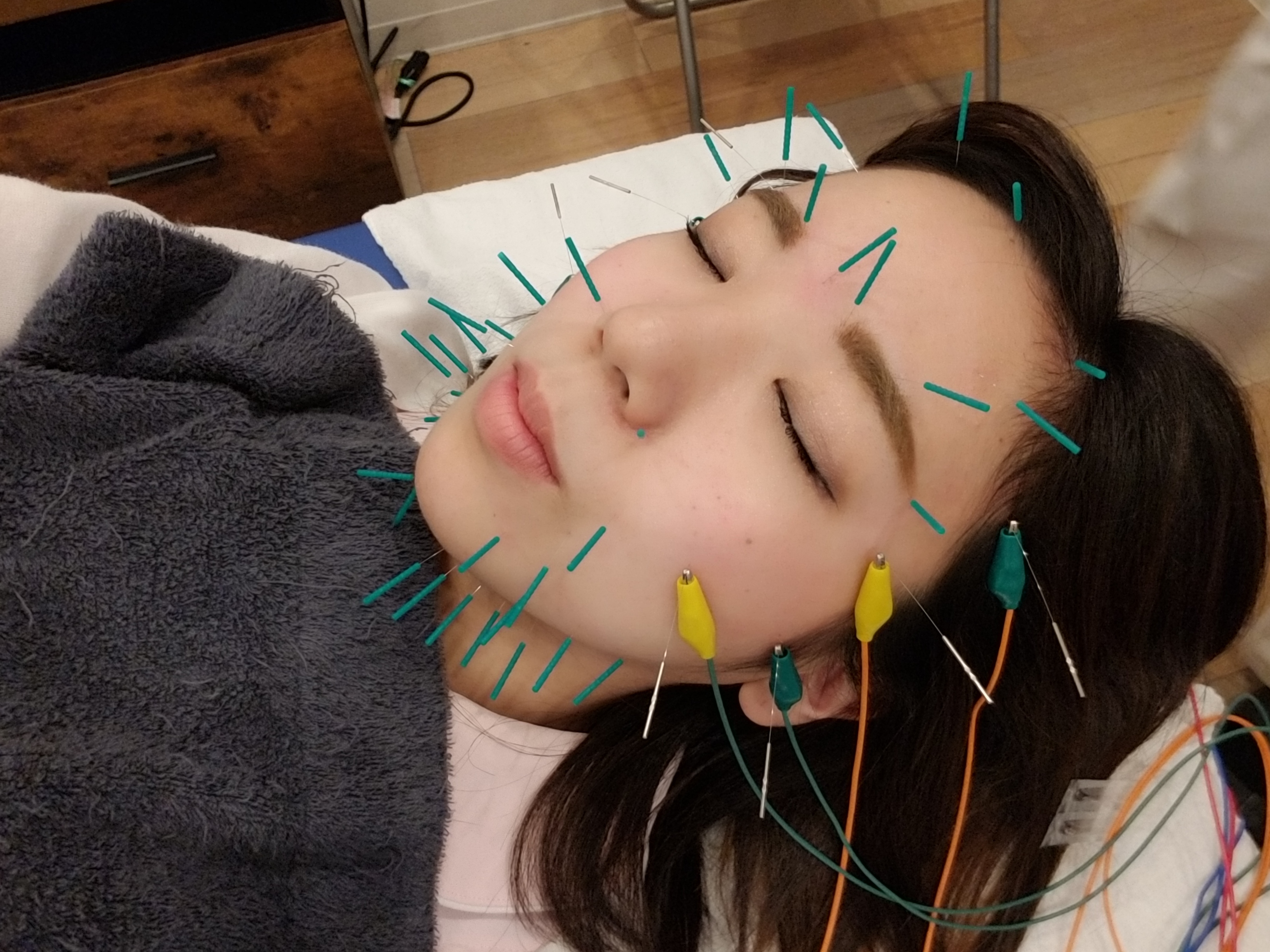 むげん整骨院 石山駅前の施術メニュー 大津市周辺の鍼灸院