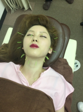 いいよし鍼灸院 美容鍼施術（初回）のメニュー画像