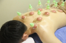 こん野鍼灸・整骨院 吸玉のメニュー画像