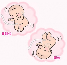 きむら鍼灸 逆子鍼灸のメニュー画像