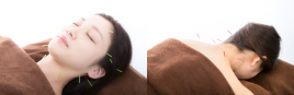 女性専門鍼灸サロン ＬＯＴＵＳ 健美コースのメニュー画像