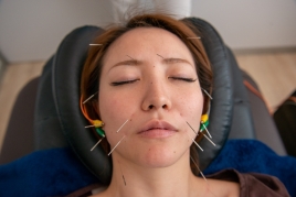 ソルエマーレ鍼灸治療院 筋膜美顔鍼のメニュー画像