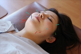 美容バランス 美容鍼ライトコース　　のメニュー画像