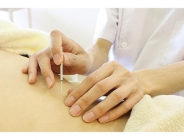 らくげん鍼灸院 鍼灸治療のメニュー画像