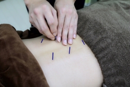 糸川鍼灸整骨院 鍼灸単体のメニュー画像