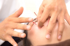 船堀ソレイユ鍼灸院 美容鍼灸トライアルのメニュー画像