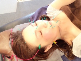 はり灸治療院 リメイク 本格治療 〜リメイク式美容鍼〜のメニュー画像