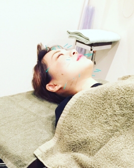 なかむら鍼灸整骨院 AMBICAL 美容鍼のメニュー画像